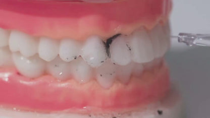 HydroPulse™ - Limpiador Dental a Presión
