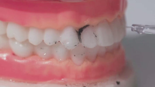 HydroPulse™ - Limpiador Dental a Presión